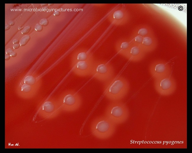 Beta hemolysis Of Group A Streptococcus S pyogenes On Blood Agar 